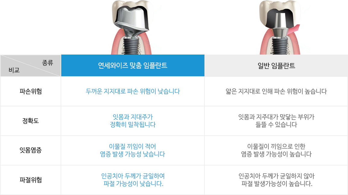 연세와이즈 맞춤 임플란트 vs 일반 임플란트