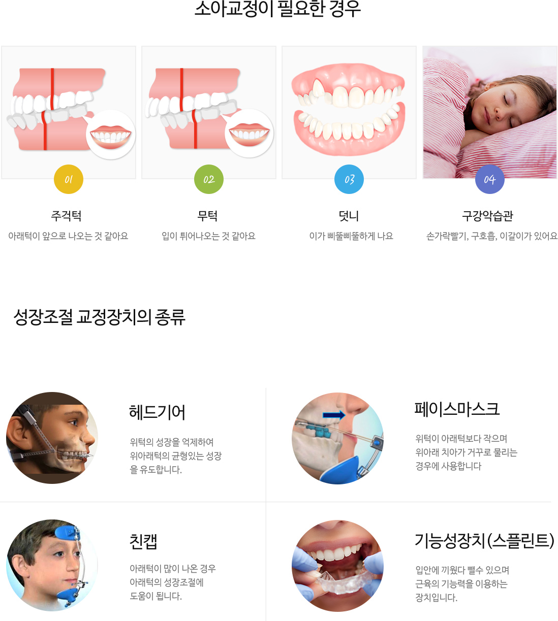 소아충치치료